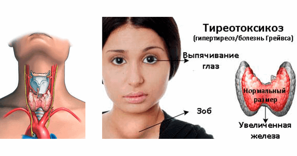 Нарушения сперматогенеза у больных транссексуализмом